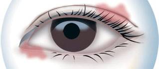 CBA***得分手發(fā)高燒吸氧0得分 教練：賓館房間新裝修，甲醛中毒導(dǎo)致的！