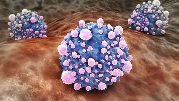 平時不注意甲醛超標(biāo)，50歲女子劇烈頭痛、惡心干嘔，一查已是癌癥晚期！