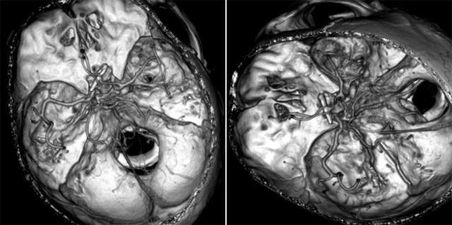 平時不注意甲醛超標(biāo)，50歲女子劇烈頭痛、惡心干嘔，一查已是癌癥晚期！