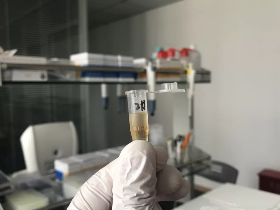 水煮花生含甲醛？實(shí)測多家燒烤店結(jié)果太可怕！