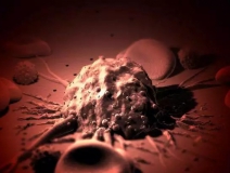 癌癥、白血病越來越多，是因為時代在進步而導致的嗎？