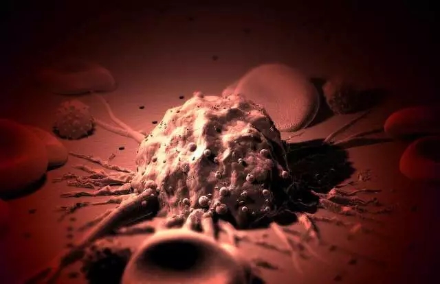 癌癥、白血病越來越多，是因為時代在進步而導(dǎo)致的嗎？